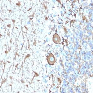 Formalin-fixed paraffin-embedded human Cerebellum stained with Neurofilament Rabbit Recombinant Monoclonal Antibody (NEFL.H/2324R).