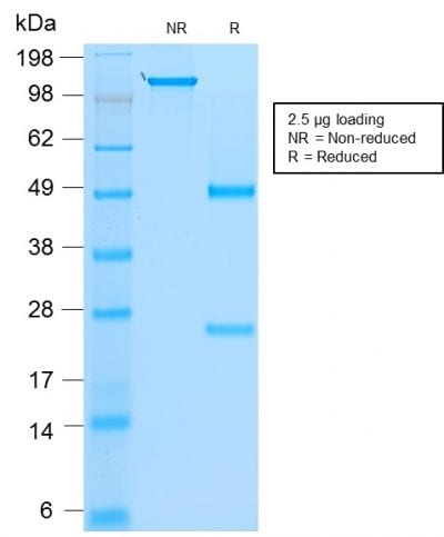 SDS-PAGE Analysis Purified MyoD1 Mouse Recombinant Monoclonal Antibody (rMYD712).Confirmation of Purity and Integrity of Antibody.