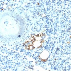 Formalin-fixed paraffin-embedded human Spleen stained with TRAcP Rabbit Recombinant Monoclonal Antibody (ACP5/2336R).