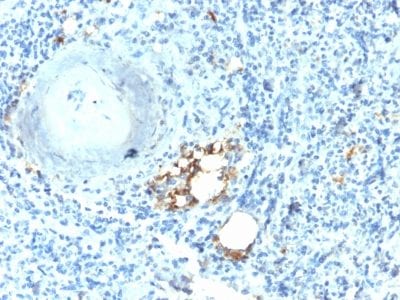 Formalin-fixed paraffin-embedded human Spleen stained with TRAcP Rabbit Recombinant Monoclonal Antibody (ACP5/2336R).
