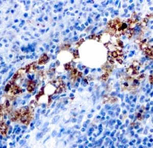 Formalin-fixed paraffin-embedded human Spleen stained with TRAcP Mouse Recombinant Monoclonal Antibody (rACP5/1070).