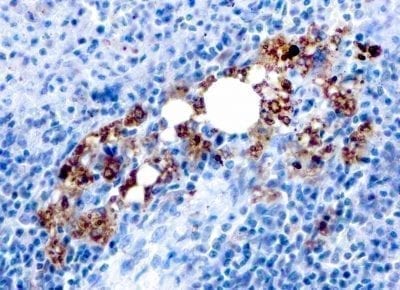 Formalin-fixed paraffin-embedded human Spleen stained with TRAcP Mouse Recombinant Monoclonal Antibody (rACP5/1070).