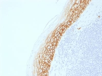 Formalin-fixed paraffin-embedded human Tonsil stained with CD44v9 Rabbit Recombinant Monoclonal Antibody (CD44v9/2344R).