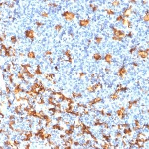 Formalin-fixed paraffin-embedded Human Tonsil stained with AIF1 / Iba1 Mouse Recombinant Monoclonal Antibody (rAIF1/1909).