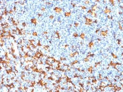 Formalin-fixed paraffin-embedded Human Tonsil stained with AIF1 / Iba1 Mouse Recombinant Monoclonal Antibody (rAIF1/1909).