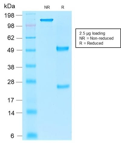 SDS-PAGE Analysis Purified EpCAM Mouse Recombinant Monoclonal Antibody (rEGP40/1110). Confirmation of Purity and Integrity of Antibody.