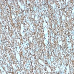 Formalin-fixed paraffin-embedded human Brain stained with Neurofilament Mouse Recombinant Monoclonal Antibody (rNF421).