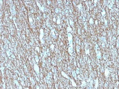 Formalin-fixed paraffin-embedded human Brain stained with Neurofilament Mouse Recombinant Monoclonal Antibody (rNF421).