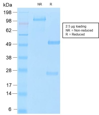 SDS-PAGE Analysis of Purified MUC16 Rabbit Recombinant Monoclonal Antibody (OCA125/2349R). Confirmation of Purity and Integrity of Antibody.