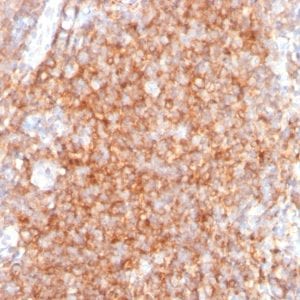 Formalin-fixed paraffin-embedded human Tonsil Stained with CD40 Mouse Monoclonal Antibody (C40/2383).
