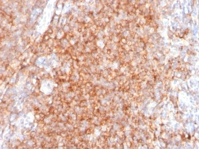 Formalin-fixed paraffin-embedded human Tonsil Stained with CD40 Mouse Monoclonal Antibody (C40/2383).