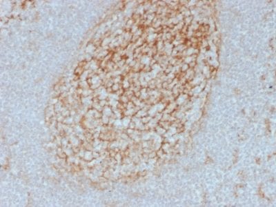 Formalin-fixed paraffin-embedded human Tonsil stained with CD14 Mouse Monoclonal Antibody (LPSR/2385).