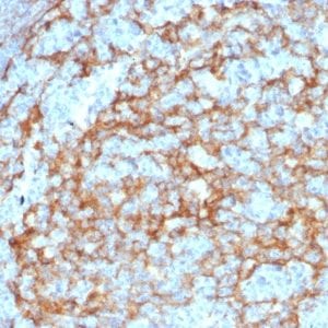 Formalin-fixed paraffin-embedded human Lymph Node stained with CD14 Mouse Monoclonal Antibody (LPSR/2385).