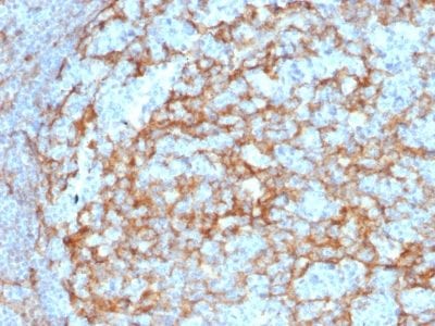 Formalin-fixed paraffin-embedded human Lymph Node stained with CD14 Mouse Monoclonal Antibody (LPSR/2385).