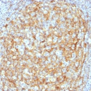 Formalin-fixed paraffin-embedded human Lymph Node Stained with CD14 Mouse Monoclonal Antibody (LPSR/2386).