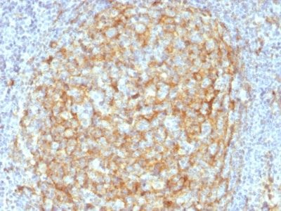 Formalin-fixed paraffin-embedded human Lymph Node Stained with CD14 Mouse Monoclonal Antibody (LPSR/2386).