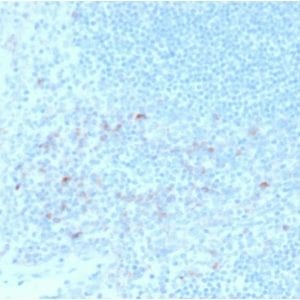Formalin-fixed paraffin-embedded human Tonsil stained with CD25Mouse Monoclonal Antibody (IL2RA/2395).
