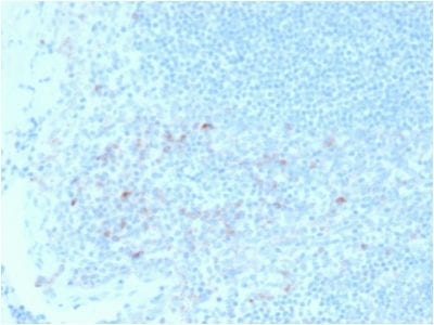 Formalin-fixed paraffin-embedded human Tonsil stained with CD25Mouse Monoclonal Antibody (IL2RA/2395).