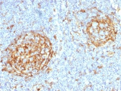 Formalin-fixed paraffin-embedded human Lymph Node stained with CD14 Mouse Monoclonal Antibody (LPSR/2397).