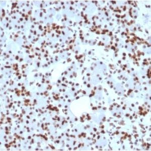 Formalin-fixed paraffin-embedded human Pancreas stained with SOX9 Mouse Monoclonal Antibody (SOX9/2398).