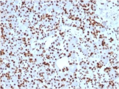 Formalin-fixed paraffin-embedded human Pancreas stained with SOX9 Mouse Monoclonal Antibody (SOX9/2398).