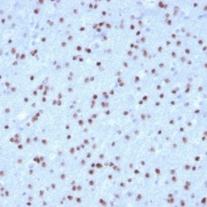 Formalin-fixed paraffin-embedded human Cerebellum stained with OLIG2 Mouse Monoclonal Antibody (OLIG2/2400).