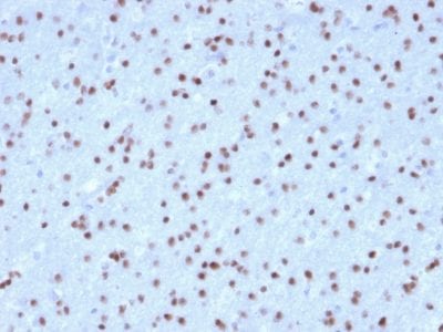 Formalin-fixed paraffin-embedded human Cerebellum stained with OLIG2 Mouse Monoclonal Antibody (OLIG2/2400).