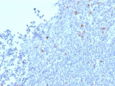 Formalin-fixed paraffin-embedded human Tonsil stained with Granzyme B Mouse Monoclonal Antibody (GZMB/2403).