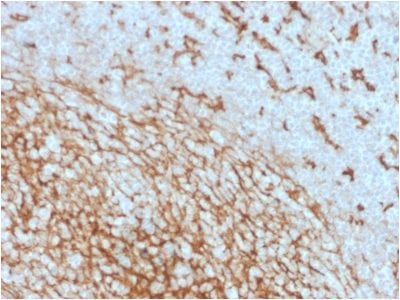 Formalin-fixed paraffin-embedded human Tonsil Stained with CD14 Mouse Monoclonal Antibody (LPSR/2408).