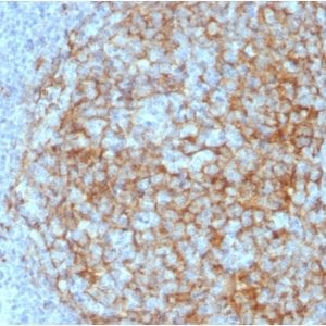 Formalin-fixed paraffin-embedded human Lymph Node Stained with CD14 Mouse Monoclonal Antibody (LPSR/2408).