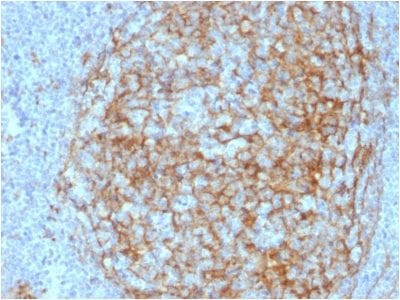 Formalin-fixed paraffin-embedded human Lymph Node Stained with CD14 Mouse Monoclonal Antibody (LPSR/2408).