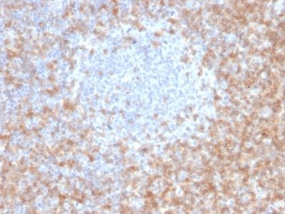 Formalin-fixed paraffin-embedded human Tonsil stained with CD5 Mouse Monoclonal Antibody (CD5/2416).