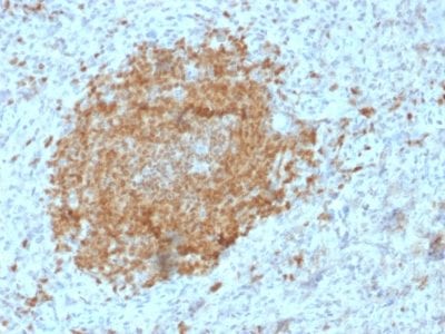 Formalin-fixed paraffin-embedded human Spleen stained with BOB1 Mouse Monoclonal Antibody (BOB1/2425).