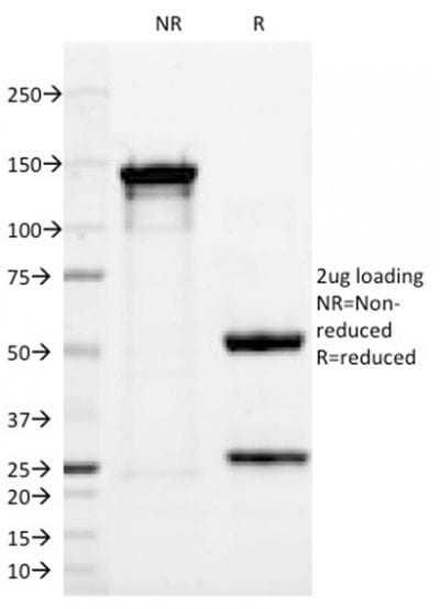 SDS-PAGE Analysis Purified p63 Mouse Monoclonal Antibody (TP63/2428).Confirmation of Purity and Integrity of Antibody.