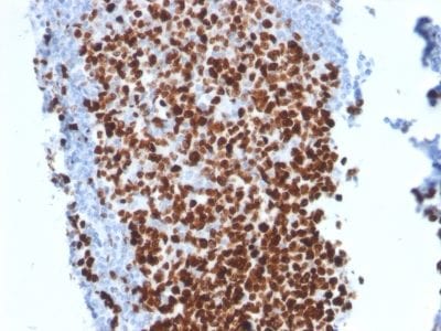Formalin-fixed paraffin-embedded human Tonsil stained with Ki67 Mouse Monoclonal Antibody (MKI67/2462).