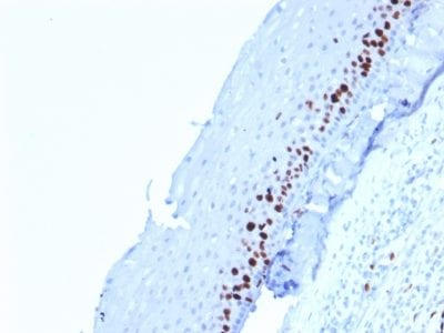 Formalin-fixed paraffin-embedded human Tonsil-Skin stained with Ki67 Mouse Monoclonal Antibody (MKI67/2462).