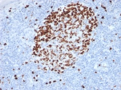 Formalin-fixed paraffin-embedded human Tonsil stained with Ki67 Mouse Monoclonal Antibody (MKI67/2462).