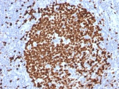 Formalin-fixed paraffin-embedded human Tonsil stained with Ki67 Mouse Monoclonal Antibody (MKI67/2465).