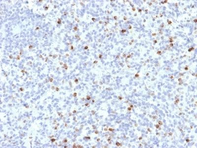Formalin-fixed paraffin-embedded human Spleen stained with Perforin-1 Mouse Monoclonal Antibody (PRF1/2468).