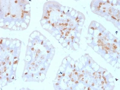 Formalin-fixed paraffin-embedded human Colon stained with CD103 Mouse Monoclonal Antibody (ITGAE/2474).