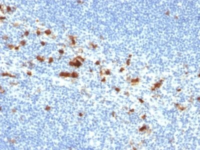 Formalin-fixed paraffin-embedded human Tonsil stained with CD103 Mouse Monoclonal Antibody (ITGAE/2474).