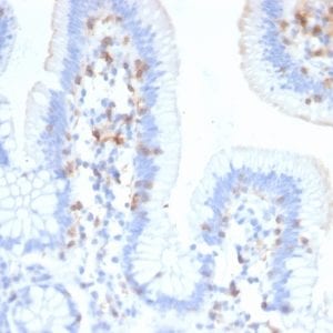 Formalin-fixed paraffin-embedded human Small Intestine stained with CD103 Mouse Monoclonal Antibody (ITGAE/2474).
