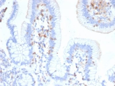 Formalin-fixed paraffin-embedded human Small Intestine stained with CD103 Mouse Monoclonal Antibody (ITGAE/2474).