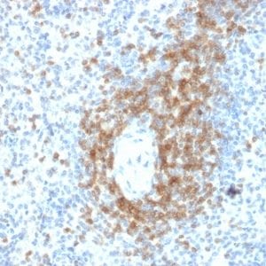 Formalin-fixed paraffin-embedded human Spleen stained with CD3e Mouse Monoclonal Antibody (C3e/2478).