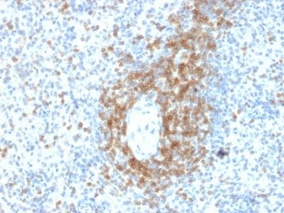 Formalin-fixed paraffin-embedded human Spleen stained with CD3e Mouse Monoclonal Antibody (C3e/2478).
