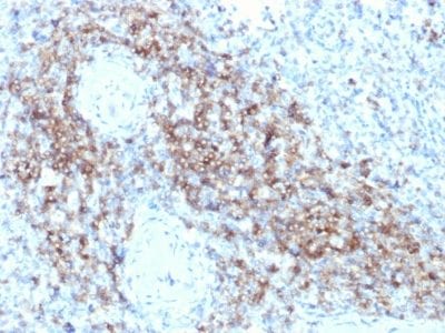 Formalin-fixed paraffin-embedded human Spleen stained with CD3e Mouse Monoclonal Antibody (C3e/2479).