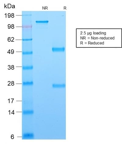 SDS-PAGE Analysis Purified BCL-6 Mouse Recombinant Monoclonal Antibody (rBCL6/1718). Confirmation of Purity and Integrity of Antibody.
