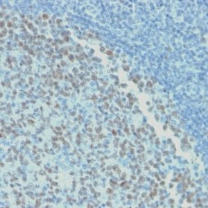 Formalin-fixed paraffin-embedded human Tonsil stained with BCL-6 Mouse Recombinant Monoclonal Antibody (rBCL6/1718).