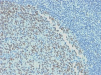 Formalin-fixed paraffin-embedded human Tonsil stained with BCL-6 Mouse Recombinant Monoclonal Antibody (rBCL6/1718).