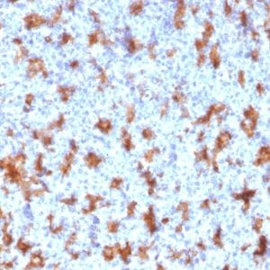 Formalin-fixed paraffin-embedded human Tonsil stained with  CD11c Mouse Monoclonal Antibody (ITGAX/2507).